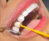 Veliko otkriće japanskih naučnika: Uspješno testirali lijek koji stimuliše rast novih zuba,  ostao još samo jedan korak